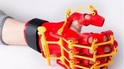 Shapeways携手EOS进军矫形器和假肢市场 3D打印重塑假肢与矫形器未来