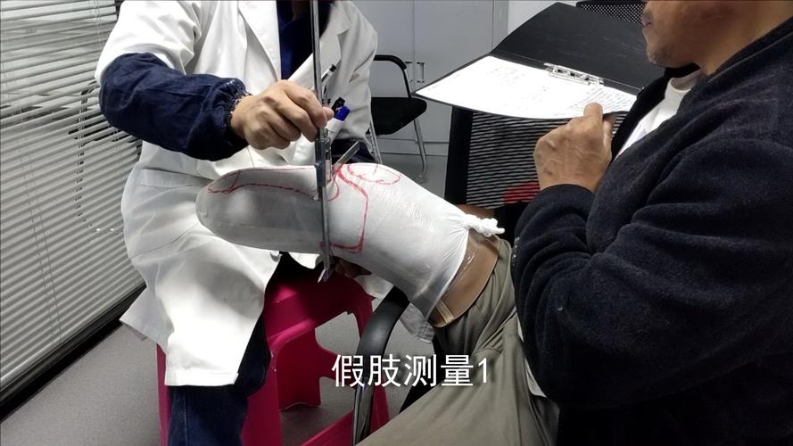 卧式雕刻机在假肢与矫形器制造中的应用与优势