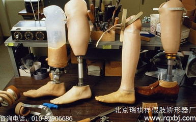 小腿假肢接受腔的选择与种类 假肢与矫形器指南
