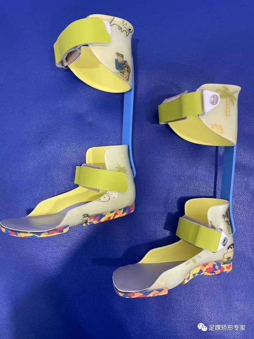 DMD/SMA患儿康复辅具系列产品介绍 矫正鞋、矫形器、定制轮椅与假肢矫形器