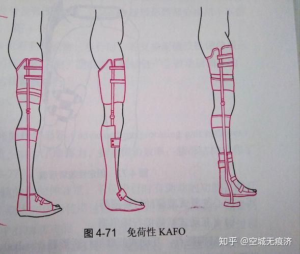 临床康复工程学中的假肢与矫形器 原理、应用与康复实践